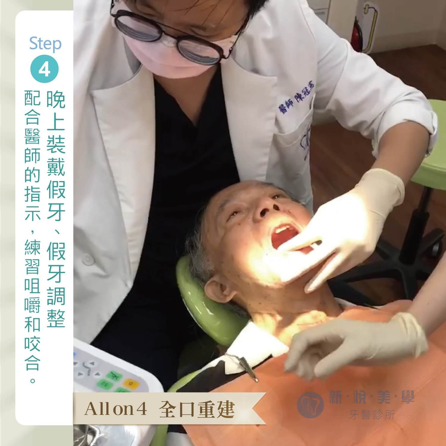 王老闆的 All on 4 微笑見證的第4張圖片